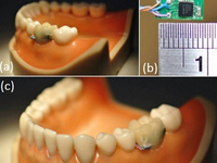 谷歌研發(fā)智能牙齒 你敢用嗎？
