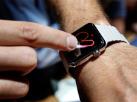 Apple Watch也過(guò)熱：導(dǎo)致用戶皮膚灼傷