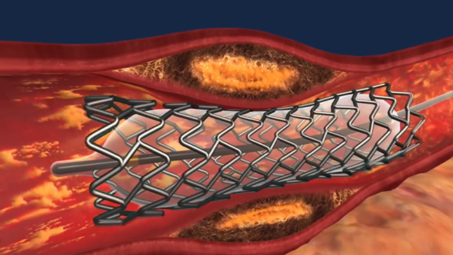 說(shuō)出來(lái)你不信 HTC Vive還用在這些領(lǐng)域