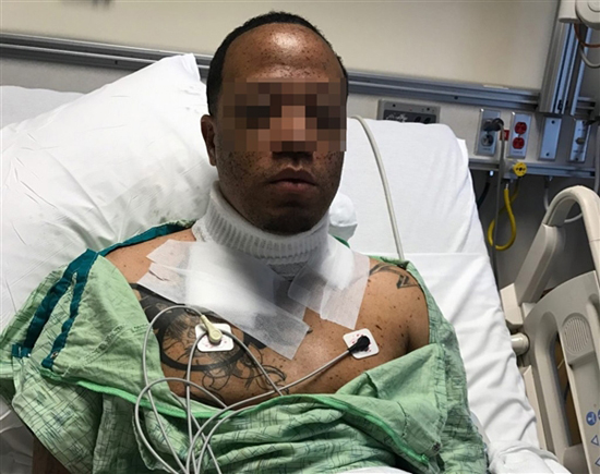 iPhone也不例外！美男子將iPhone放枕邊充電發(fā)生點擊