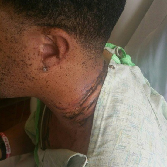 iPhone也不例外！美男子將iPhone放枕邊充電發(fā)生點擊